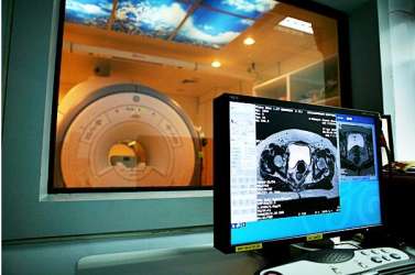 เครื่องจำลองการฉายรังสีด้วยภาพสะท้อนคลื่นแม่เหล็กไฟฟ้า (MRI simulator)